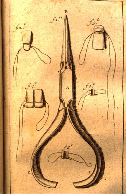 Dental needle-nose pliers designed by Fauchard in the late 17th century to use in prosthodontics.