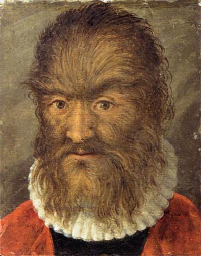 The Hairy Man from Munich by 16th century unknown painter.