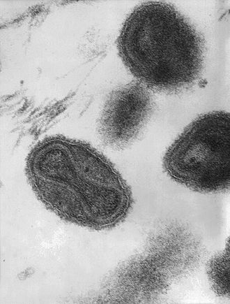 This transmission electron micrograph depicts a number of smallpox virions. The “dumbbell-shaped” structure inside the virion is the viral core, which contains the viral DNA. Magnification 370,000 x.