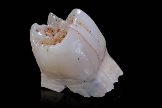 tooth