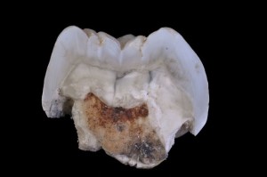 tooth