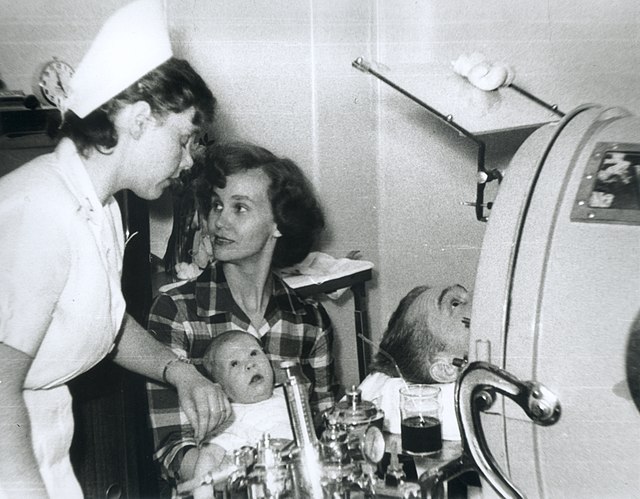 Polio patient in an iron lung, surrounded by his family and a nurse