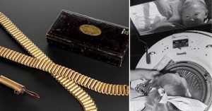 Pulvermacher chain and child in iron lung