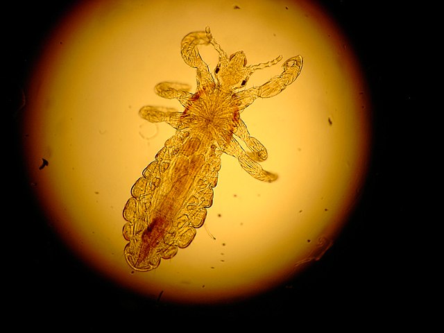 A louse as seen from under a microscope