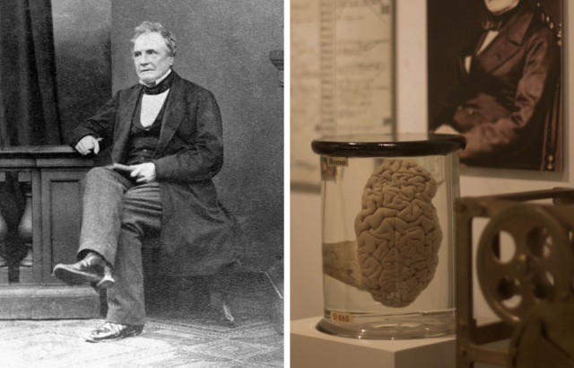 Left: Portrait of Charles Babbage. Right: Babbage's brain on display in a glass jar.