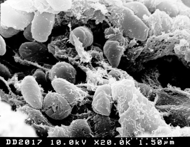 Black and white photo through a microscope of the Yersina Pestis bacteria