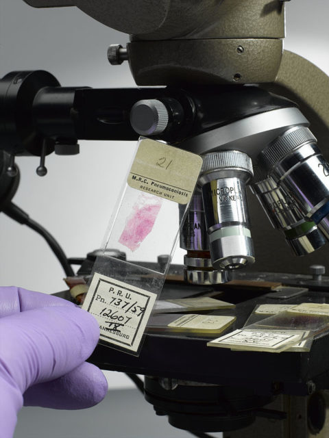 Inspecting lung tissue under a microscope