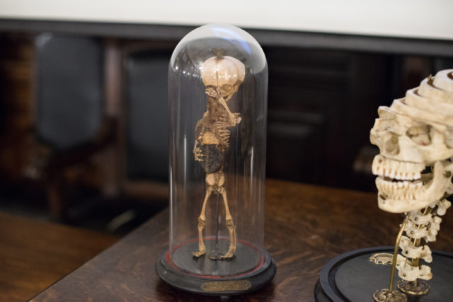 The skeleton of a dwarf on display at the Mütter Museum