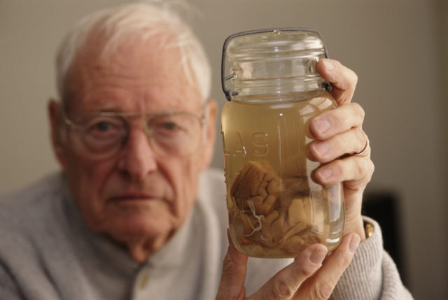 Thomas Harvey holding a brain in a jar at the Mütter Museum