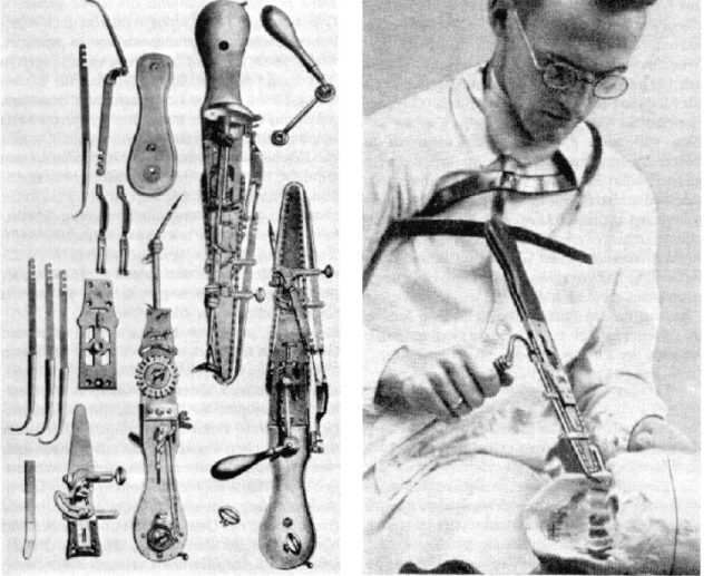 A photograph of osteotome instruments from a 1920s medical catalogue