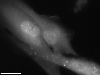 An x-ray shows the loss of cells after radiation exposure. 