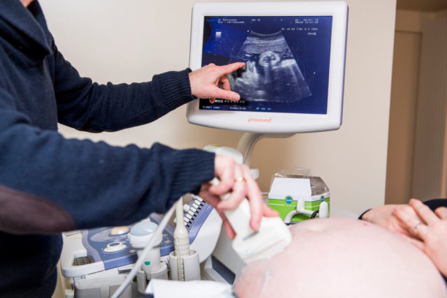 Doctor conducting an ultrasound on a pregnant woman while pointing to the baby on the monitor.