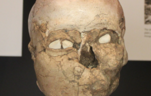 Close-up image of a skull with plaster on it and shells in the eye sockets