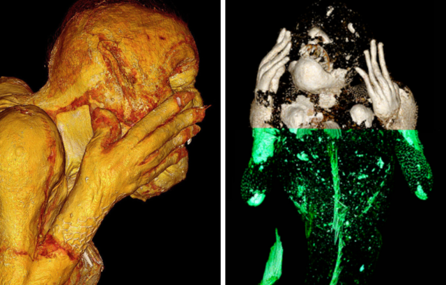 Side by side images of CT scans of the mummy