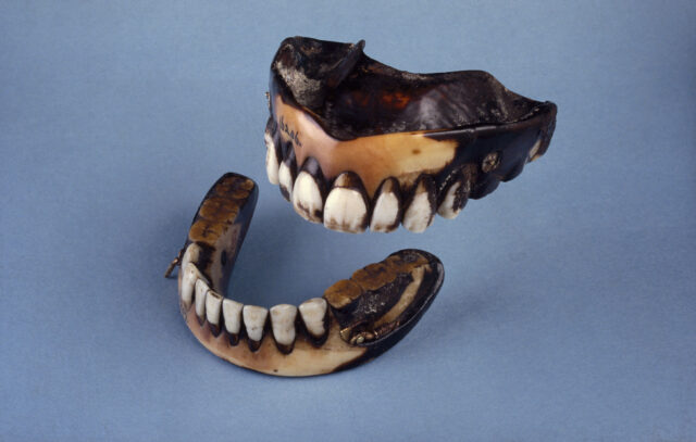 Set of ivory dentures displaying their age with greatly discolored areas. 