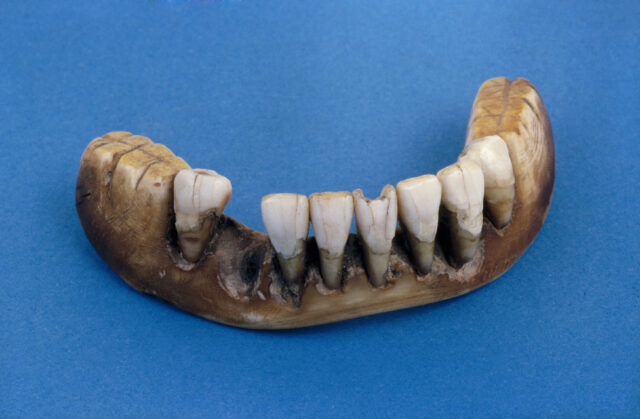 Lower denture set made of elephant ivory with human teeth. Note the molars are carved from ivory, making it easier to produce. 