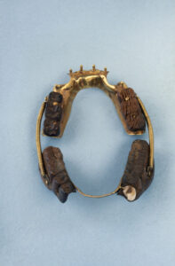 Teeth Taken From Fallen Soldiers at Waterloo Were Used to Make Dentures ...