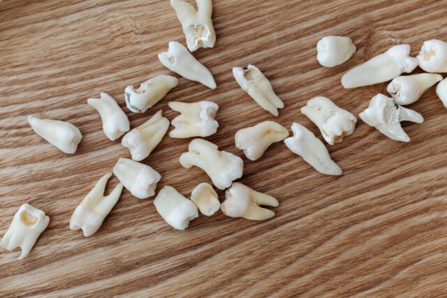 Loose human teeth scattered on a wooden table.