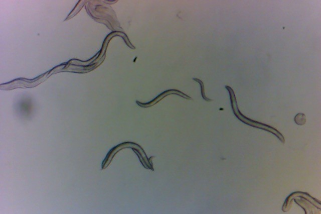 Microscope image of nematodes.