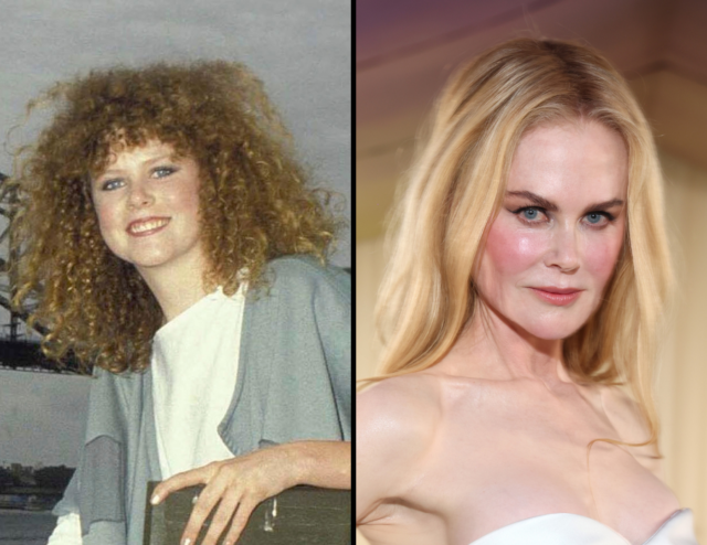 Young Nicole Kidman, old Nicole Kidman.